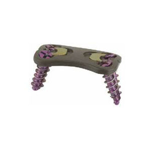 Spinal screws